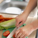 hands-patient-suffering-from-psoriasis